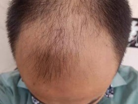 理发时听理发小哥推荐,新买了一款号称可以生发的洗发液:禾道一【落洗安】
