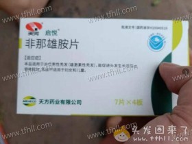 开始使用生发的终极奥义:非那雄胺+米诺地尔+微针