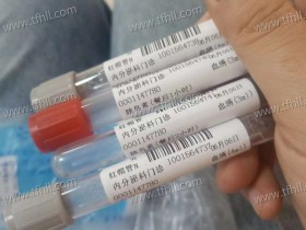 两天抽了四次血,我都对抽血开始胆颤了