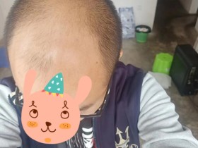 一个好消息:我的头上又长出了许多小绒毛