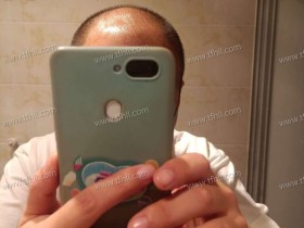 使用微针+zix的第二天