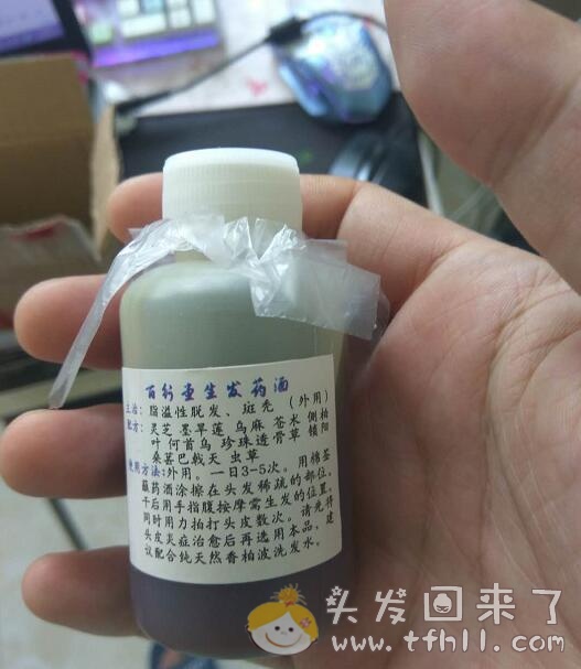 尝试新的治疗脂溢性脱发的中药产品-生发药酒（外用篇）图片 No.3