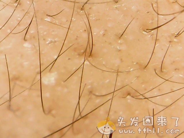 头皮检测仪记录头发状态（2021.4.22）图片 No.7