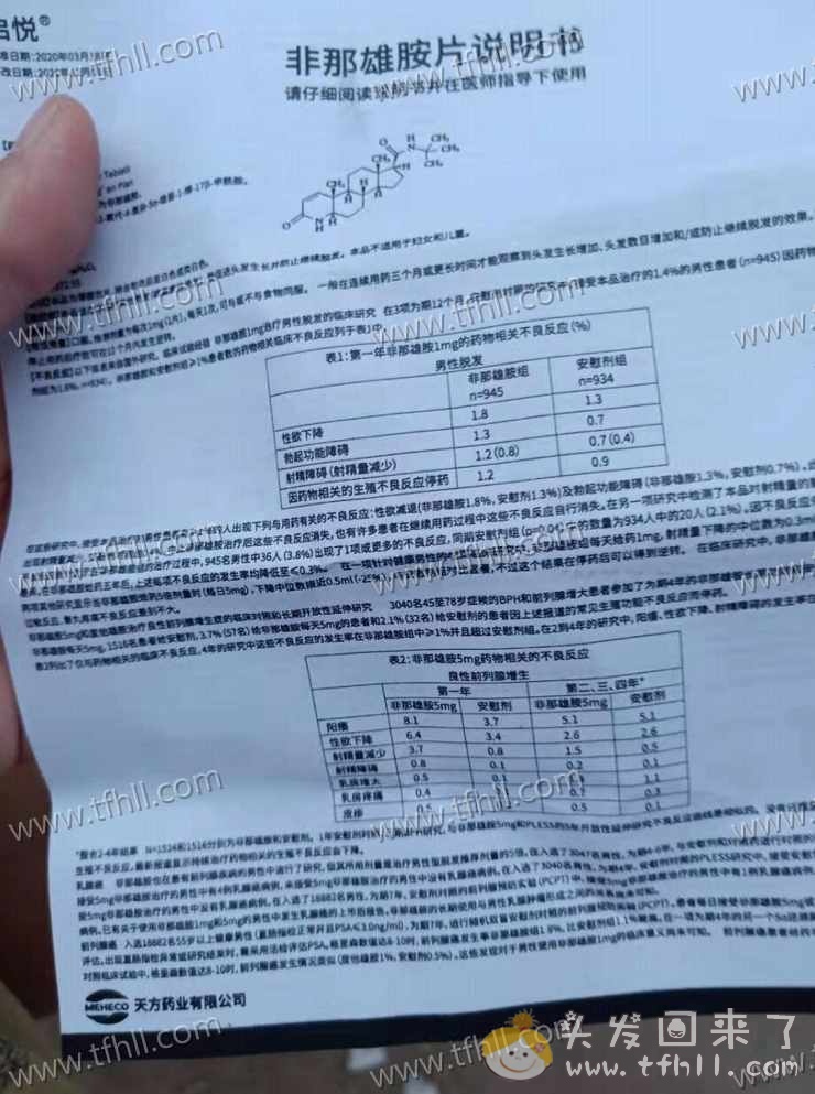 开始使用生发的终极奥义：非那雄胺+米诺地尔+微针图片 No.3