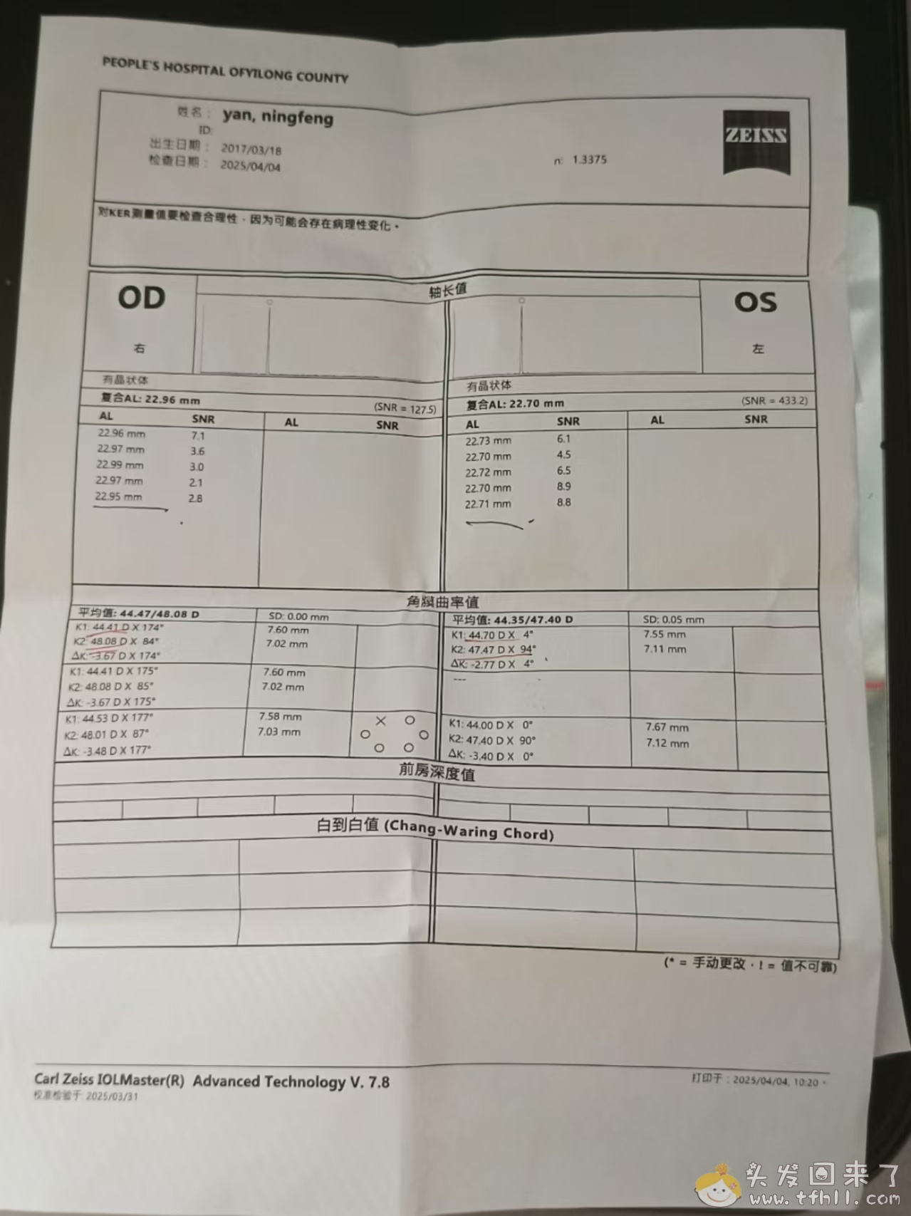 清明假期间，给二年级小朋友配了一幅近视眼镜图片 No.2